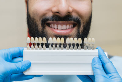 The Marvels of Dental Implants